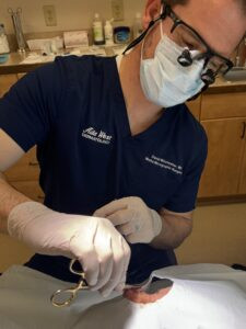 Dr. Winchester performs mohs surgeron the the nose of a patient covered by surgical drape.