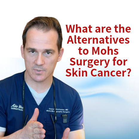 What are the alternatives to mohs surgery for skin cancer